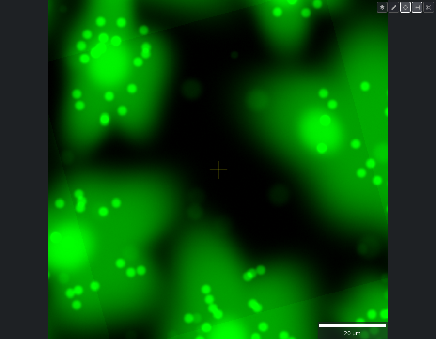 GFP